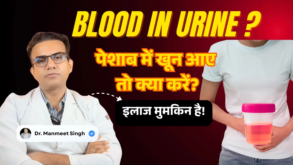 Blood in Urine Hematuria Treatment in Lucknow - Dr Manmeet Singh